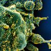 Diese Aufnahme des US-Forschungszentrums „National Institute of Allergy and Infectious Diseases“ zeigt eine mit Coronaviren (gelb) infizierte Zelle. 