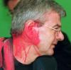 Mai 1999: Joschka Fischer (Grüne), kurz nachdem er auf dem Sonderparteitag der Grünen zum Kosovo-Krieg von einem Farbbeutel getroffen wurde.