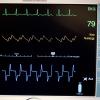 Seit 30 Jahren läuft die Gesundheits-Studie Kora in der Region Augsburg.