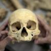 In einer Kiesgrube im Unterallgäu sind menschliche Knochen gefunden worden. 