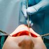 Eine 46-Jährige lässt sich mehrere Zähne ziehen und wacht nie wieder auf. Nun muss der Anästhesist für seine Fehler ins Gefängnis.