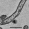 Der Tuberkulose-Erreger Mycobacterium tuberculosis, aufgenommen unter dem Elektronenmikroskop.