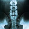 Fast 90 Prozent aller Menschen leiden mindestens einmal in ihrem Leben an Rückenschmerzen, sagt Prof. Dr. Cakir. 