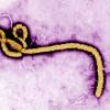 So sieht das Ebola-Virus unter dem Mikroskop aus: Die Ebola-Epidemie in Westafrika wird nach Ansicht von US-Experten noch mindestens 12 bis 18 Monate dauern. 