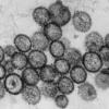So sieht das Hantavirus unter dem Mikroskop aus. Symptome einer Infektion sind Kopf- und Gliederschmerzen sowie hohes Fieber. 