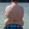 Übergewicht (Adipositas) kann die Lebenserwartung um bis zu zehn Jahre verringern. Ein besonders hohes Risiko dafür tragen übergewichtige Männer.