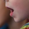 Kinder und Jugendliche in Deutschland haben in den vergangenen Jahren immer häufiger sprachtherapeutische Behandlungen benötigt.