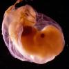 Im Laufe von durchschnittlich 38 Wochen entwickelt sich eine befruchtete Eizelle zu einem vollständigen Menschen. Bis zur zwölften Schwangerschaftswoche dürfen Embryonen aber abgetrieben werden. 