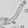 Der Tuberkulose-Erreger Mycobacterium tuberculosis, aufgenommen unter dem Elektronenmikroskop. 