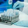 Ein Mitarbeiter hält in einem Coronatest-Labor der Limbach Gruppe PCR-Teströhrchen in den Händen. Die Zahl der im Labor bestätigten Corona-Fälle in Deutschland steigt wieder, allerdings auf relativ niedrigem Niveau.