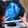 Menschen unter 50 Jahre erkranken am häufigsten an Brustkrebs, zeigt eine neue Studie.