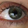 Augen: Verzerrte Sicht kann auf Makula-Degeneration hindeuten