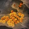 Eine undatierte elektronenmikroskopische Aufnahme des «U.S. National Institute of Health» zeigt das neuartige Coronavirus (SARS-CoV-2) (orange), das aus der Oberfläche von im Labor kultivierten Zellen (grau) austritt. Die Probe wurde von einem Patienten in den USA isoliert.