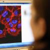 Eine Studie in den USA zu einer neuartigen Immuntherapie gegen Krebs, bei der T-Zellen eingesetzt werden, musste kurzzeitig unterbrochen werden. 