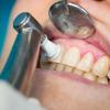 Viele Menschen haben mit entzündetem oder blutendem Zahnfleisch zu kämpfen. Ursache könnte ein Vitamin-Mangel sein. 