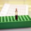 Eine Blutprobe liefert viele Daten eines Patienten - zum Beispiel die DNA. In Zukunft soll sie auch helfen, Krebs vorherzusagen. Die Methode ist umstritten.