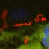Treponema pallidum, der Erreger der Syphilis. Eine Sonde zeigt die Spiralbakterien (rot) im Gewebe (grün), Zellkerne (blau). In Deutschland steigt die Zahl der Fälle wieder an.