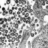 Elektronenmikroskopische Aufnahme von Lassaviruspartikeln aus Zellkulturen.