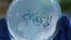 Eine Schale mit E.coli Bakterien in einem Labor in Hannover. dpa