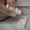 Ein Fachmann führt einen HIV-Test durch. Der Wissensstand zu HIV sei laut Experten seit vielen Jahren auf einem hohen Niveau.