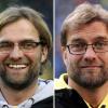 Die Bild-Kombo zeigt den Trainer von Borussia Dortmund, Jürgen Klopp. Der 45-Jährige hat sich Haare einpflanzen lassen. Das bestätigte der Fußball-Coach der «Bild»-Zeitung. 