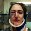 Mit Verletzungen im Gesicht kam eine 23 Jahre alte Münchnerin ins Krankenhaus.
