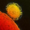 Die Elektronenmikroskop-Aufnahme zeigt das tödliche Coronavirus Mers.
