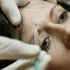 Botoxbehandlungen sind gefragter denn je. Besonders junge Frauen greifen immer häufiger darauf zurück.