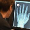 Ein Radiologe schaut sich im Röntgenbild die linke Hand eines 17-Jährigen an.