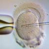 Ein Spermium wird eine Eizelle injiziert. Wird die Eizellenspende bald legal? (Archivbild)