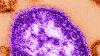 Diese Aufnahme zeigt Teile eines Masernvirus. Masern sind eine vielfach unterschätzte Infektionskrankheit.