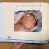 Eine Seite in einem Fotoalbum zeigt Moritz Fischer im künstlichen Koma auf der Intensivstation für Neugeborene (Neonatologie) der Uniklinik Würzburg im Jahr 2011.