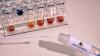 Pflegebeschäftigte in Kaufbeuren und dem Ostallgäu benötigen zum Dienstantritt künftig einen negativen PCR-Test. 