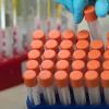 Trotz zahlreicher Testungen auf der Landkreis-Teststrecke wurden am Montag keine neuen Covid-19-Infektionen festgestellt.