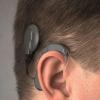 Im Jahr 1984 wurde das erste Cochlea-Implantat in Deutschland an der Medizinischen Hochschule Hannover implantiert. Heute sind bundesweit etwa 60.000 Menschen mit dieser Hörprothese versorgt.