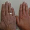 Wie lang ist der Ringfinger, wie lang der Zeigefinger? Das Längenverhältnis gibt Auskunft über den Charakter. Im Bild eine weibliche und eine männliche Hand.