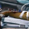 Aus für die Dialysestation: Durch die jetzt beschlossene geänderte Ausrichtung der Sinntalklinik, fällt der Schwerpunkt Nierenheilkunde komplett weg. Ein schwerer Schlag für das Nierenheilbad Brückenau.