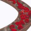 „Thrombosen muss man ernst nehmen“