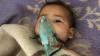 Ein syrisches Kind wird nach einem mutmaßlichen Gasangriff in einem Krankenhaus behandelt.
