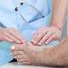 Hallux valgus: Meist hilft nur eine Operation.
