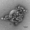 Weniger Norovirus-Infektionen als im Vorjahr