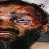 Osama Bin Laden, der meistgesuchte Terrorist der Welt, ist tot. Das sagte US-Präsident Barack Obama in einer Fernsehansprache am Sonntag (1. Mai 2011). Mindestens zwei pakistanische Fernsehsender haben am Montag das entstellte Gesicht einer Leiche gezeigt, bei der es sich um den getöteten El-Kaida-Chef Osama bin Laden handeln soll. Eine offizielle Bestätigung gibt es nicht.  Nach Medienberichten hingegen soll es sich um eine Fälschung handeln.