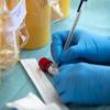 Mittlerweile sind in Deutschland mehr als 7400 mit dem Erreger Sars-CoV-2 Infizierte gestorben.