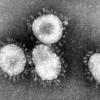 Ein Coronavirus unter dem Mikroskop.
