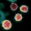 Eine Aufnahme zeigt das Virus, das COVID-19 verursacht.