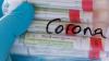 Proben für Corona-Tests werden einem Labor für die weitere Untersuchung vorbereitet.