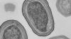Elektronenmikroskopische Aufnahme von Prochlorococcus-Zellen. Elektronenmikroskopische Aufnahme von Prochlorococcus-Zellen.