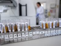 Blut ist nicht gleich Blut: Entscheidend für die Einsortierung in eine Blutgruppe ist, welche Antigene sich auf der Hülle der roten Blutkörperchen befinden.