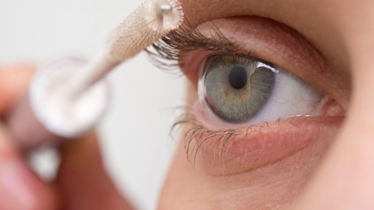 Augenringe-durch-Wimpernserum-Arzt-warnt-vor-Nebenwirkungen