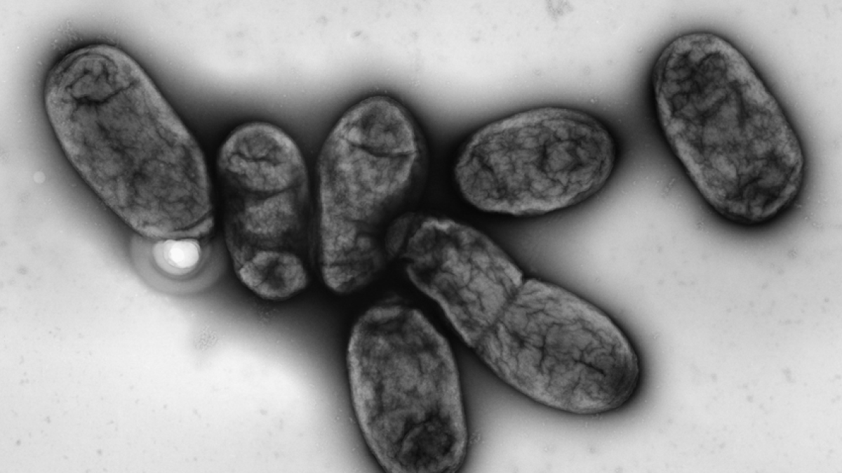 WHO questions Irkutsk lab worker pneumonia death